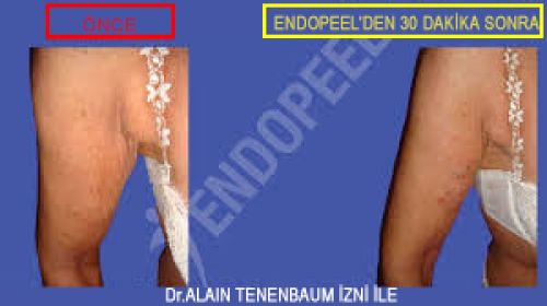koltuk altları