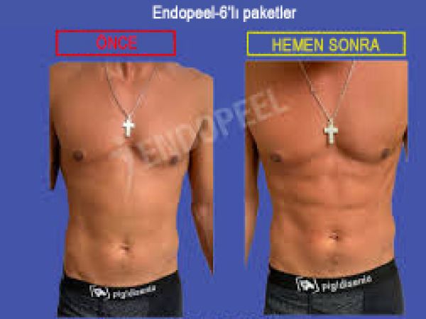 vücut endopeel