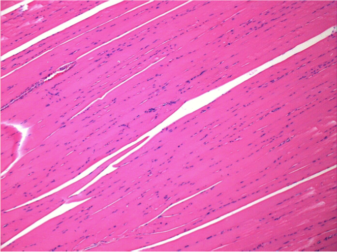 NaCl enjeksiyonundan sonra