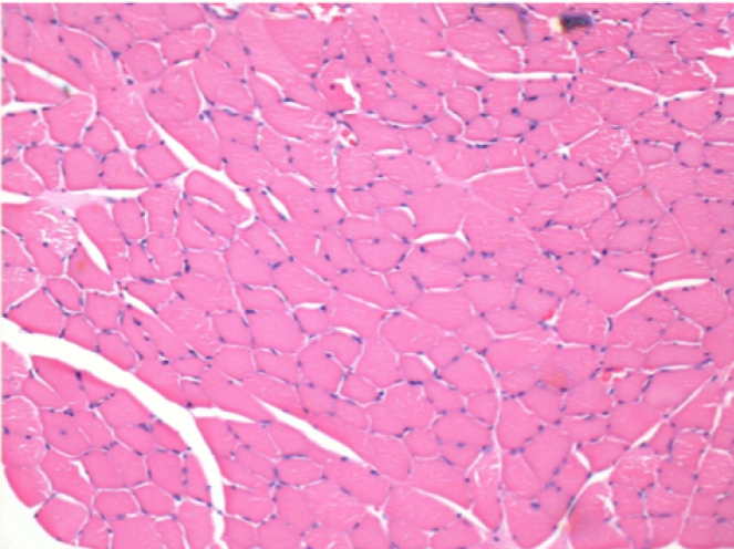 sol kontrol - 100xD10