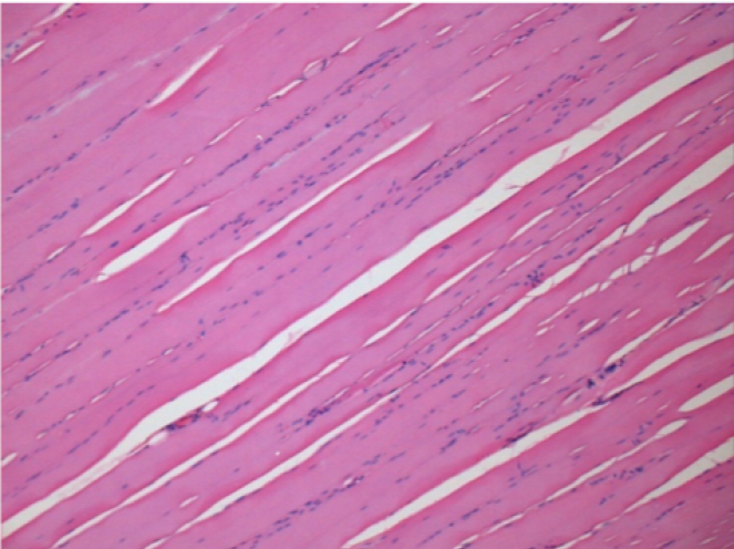 Sol Kontrol- 100xD210