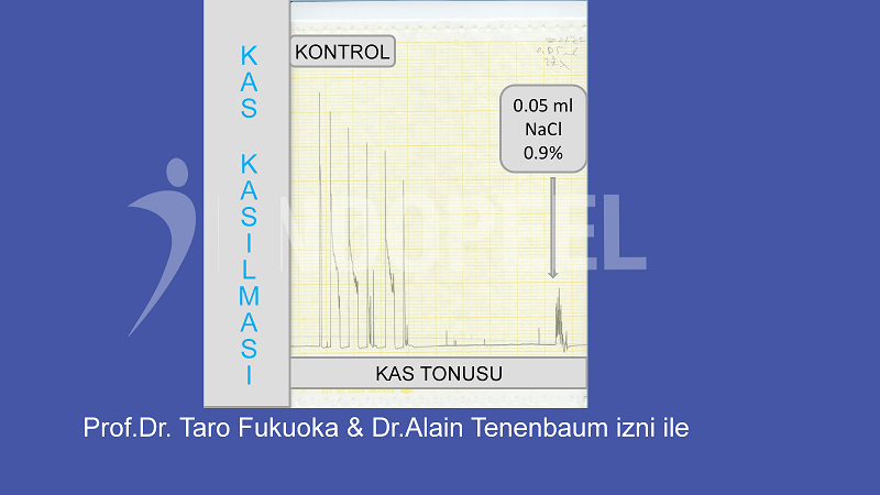 Kas Kasılması ve Kas Tonus Kontrol&uuml;